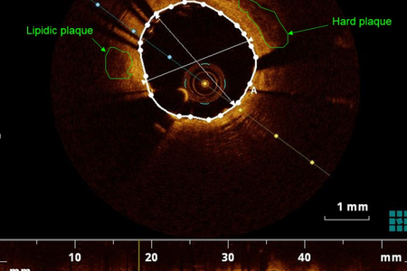 Artery image